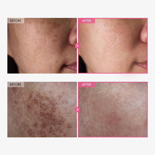 TOSOWOONG TOSOWOONG Arbutin 7% + Tranexamic Acid 4% Face Cream 50ml - image 2
