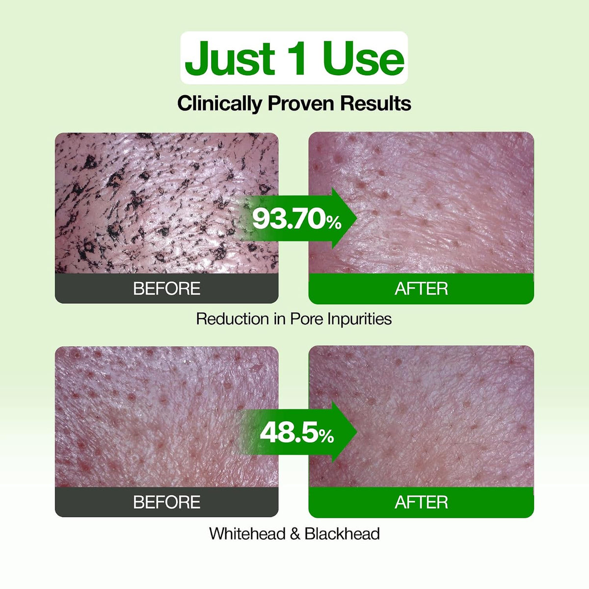 FULLY FULLY Green Tomato Pore Clay Mask Cleanser for Deep Cleansin - image 5