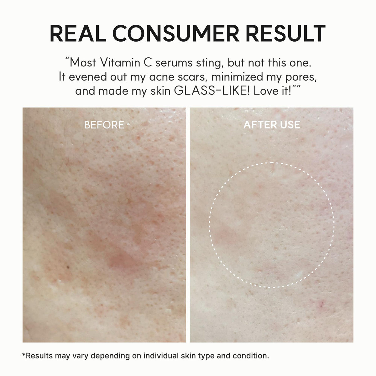 VICAFUCI Vitamin C Booster Shot Serum with Glutathione & Niacinamide - image 7